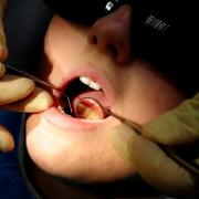 There were around 140 hospital admissions in Bury to remove children's decaying teeth last year