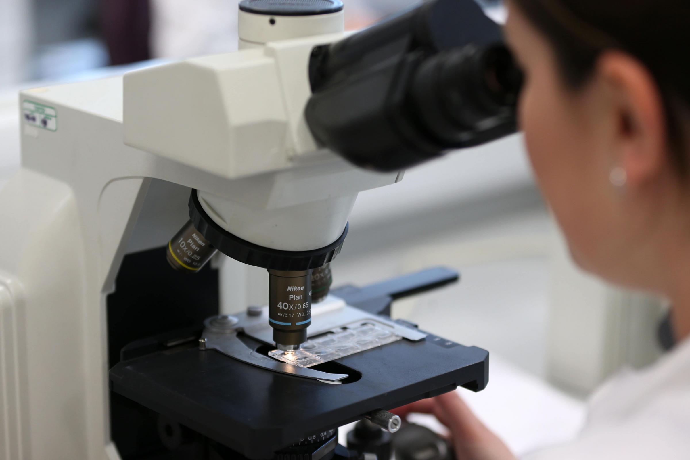 Biggest study of its kind implicates specific genes in schizophrenia - Vimarsana News