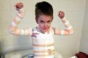 Rhys Williams, aged 12, suffers from agonising skin condition epidermolysis bullosa